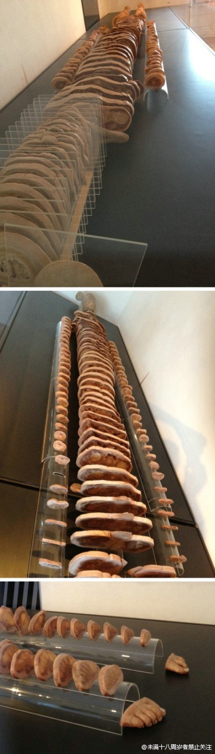 这是收藏在芝加哥国际外科学博物馆里的人体解剖切片,每个横截面厚度