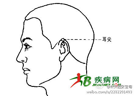 降血压,有一个简单办法就是指甲掐耳尖,用血糖针放几滴血会有奇效