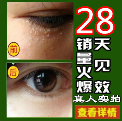 眼霜起脂肪粒