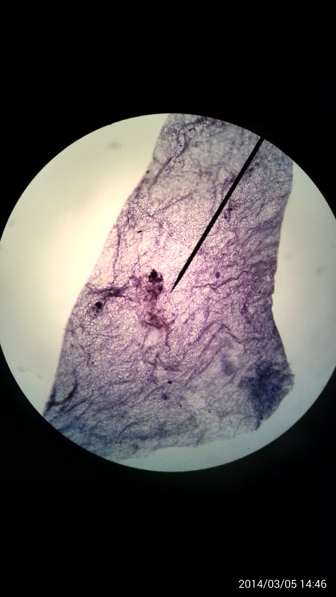 10*10倍显微镜下的念珠藻.