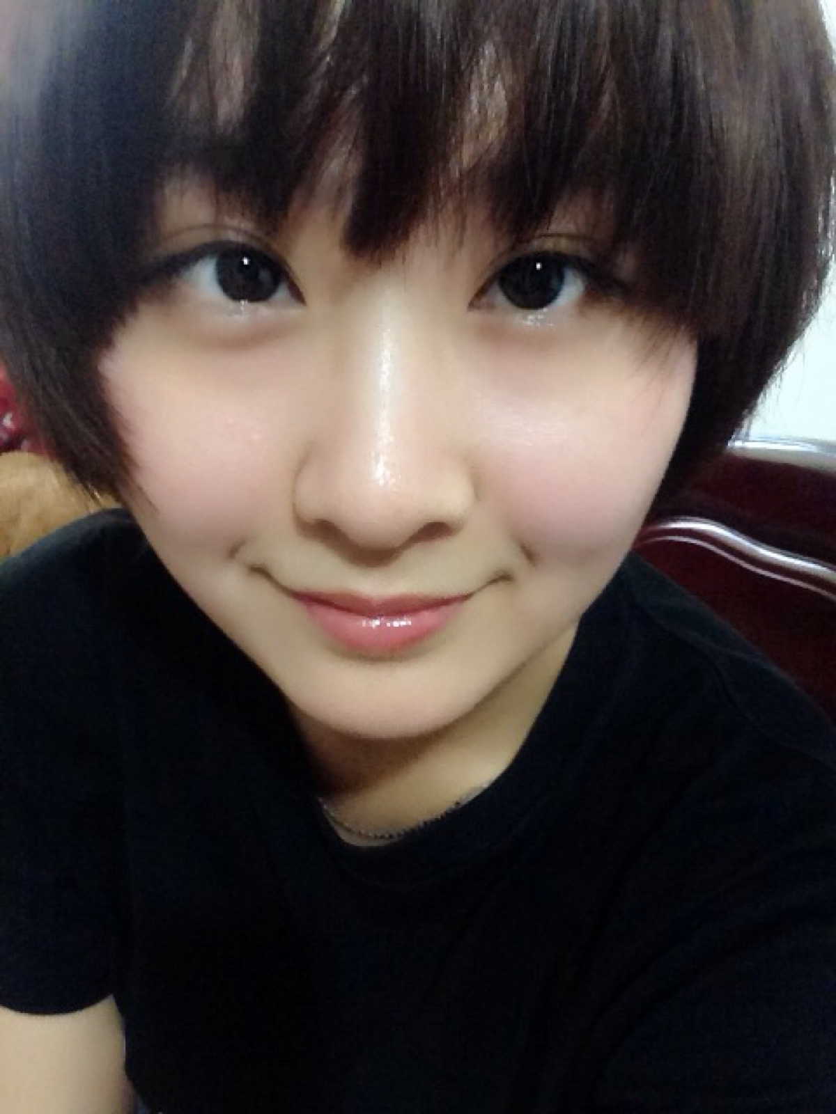 斗鸡眼 
