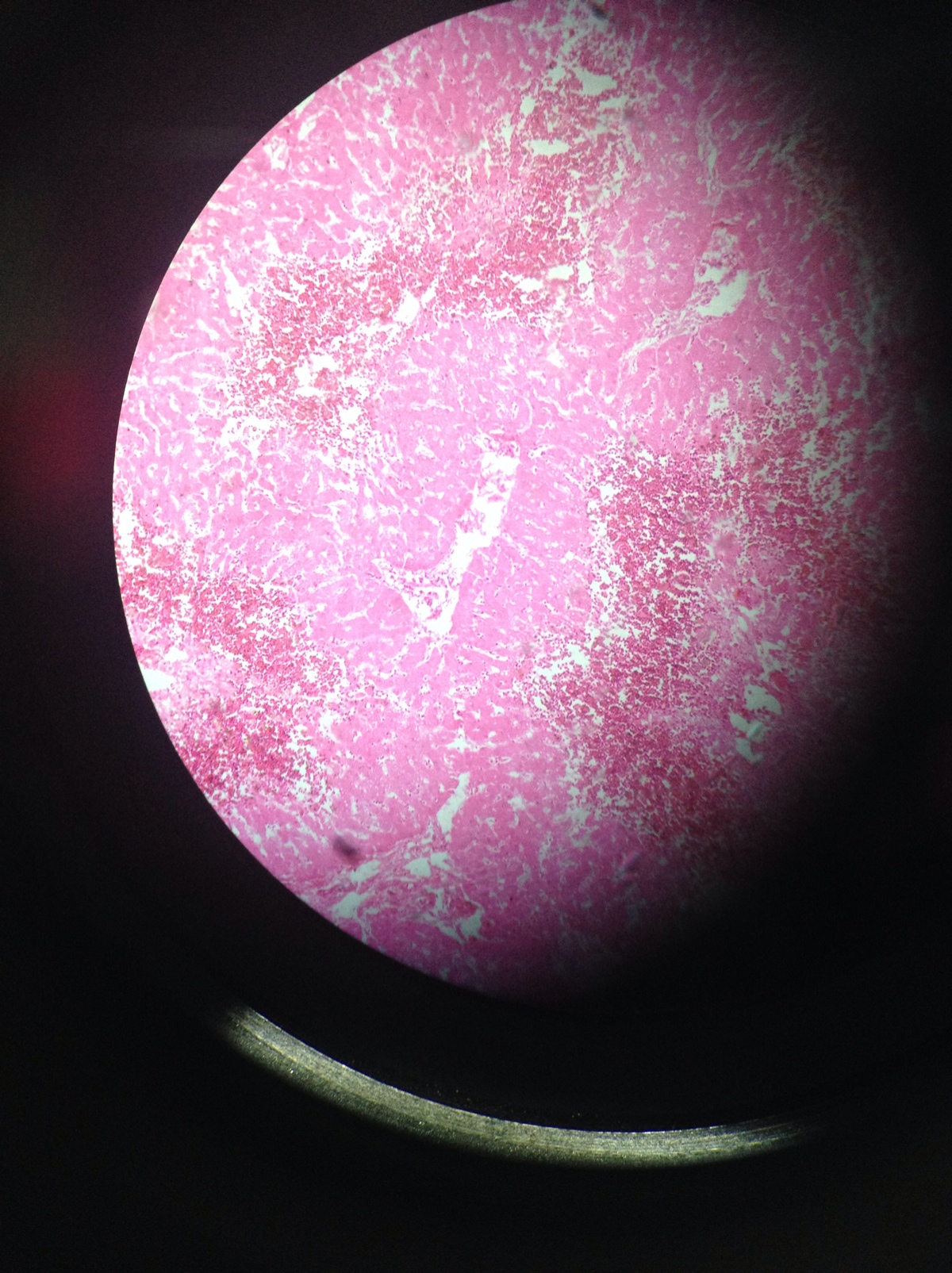 显微镜下的肝淤血