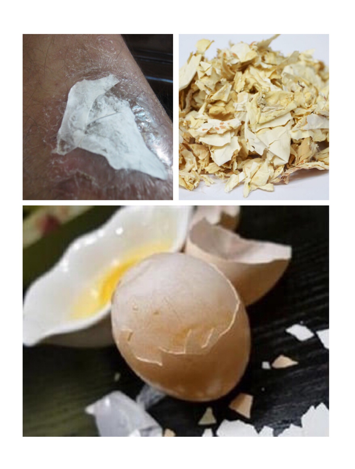 切菜时不小心把手弄破了,也可以把凤凰衣剥下来贴在伤口上,可以收敛