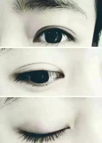 女生 双眼皮太好看了