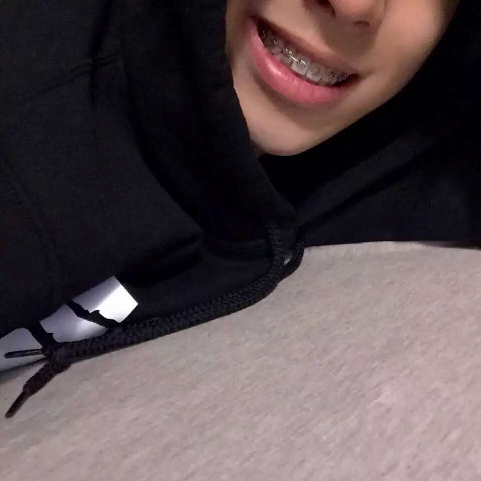 金善彬# #男头# 牙套