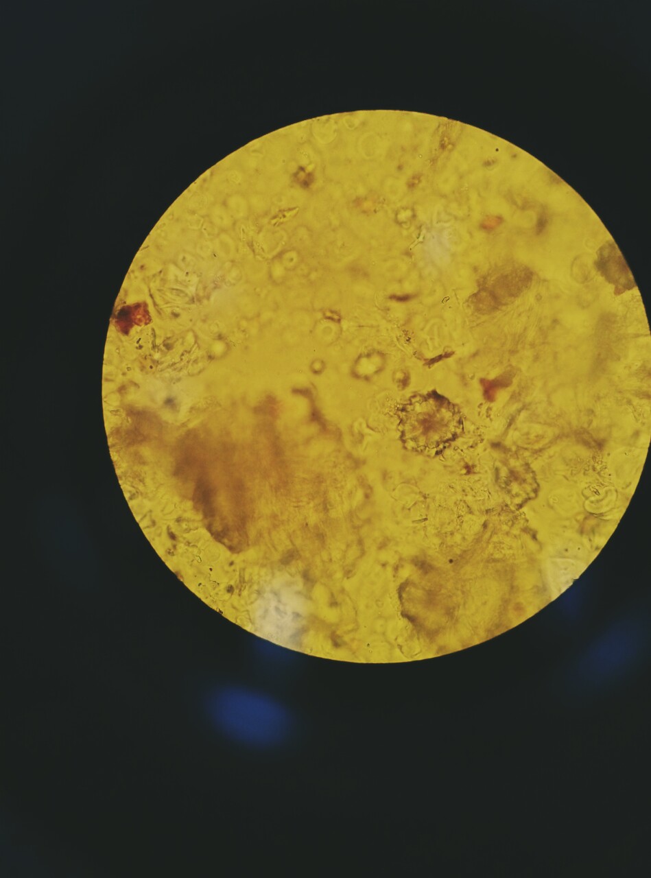 五味子石细胞显微图片图片