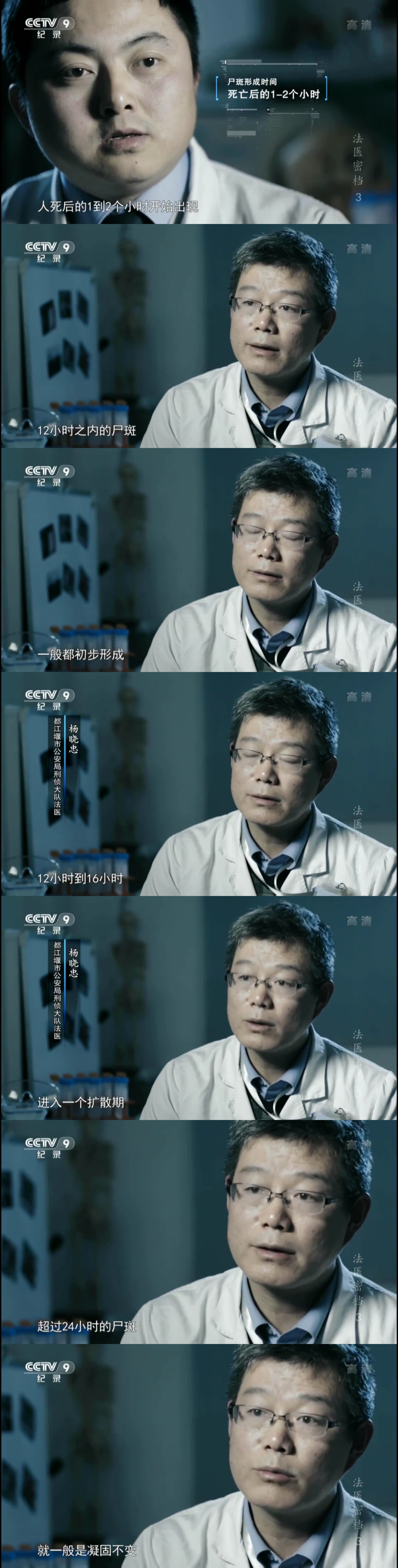 纪录片[法医密档]根据尸斑的形成状况判断死者死亡时间.