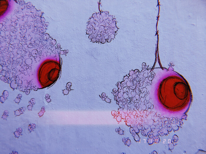 尼曼匹克细胞形态图片