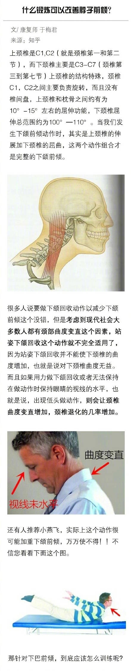 什么锻炼可以改善脖子前倾