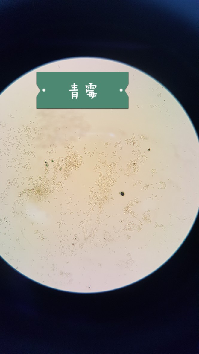 青霉菌油镜图片图片