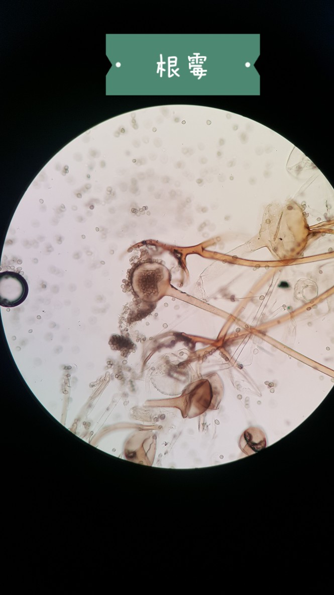 米根霉孢子形态图片