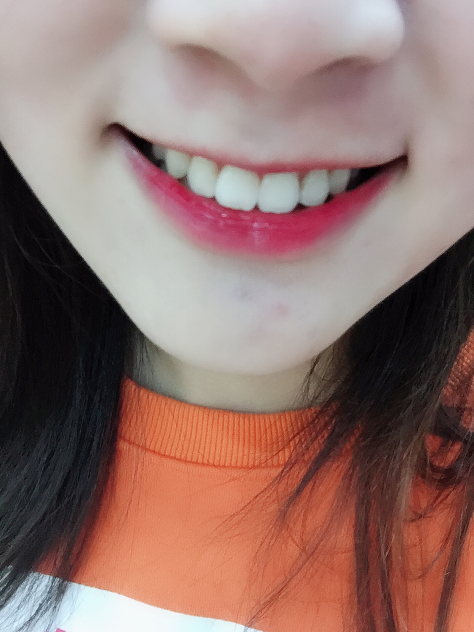 唯爱美牙仪反馈连续使用了一个星期小黄牙明显变白了颜值都增加了