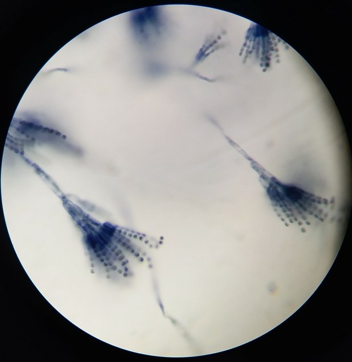 青霉菌显微镜手绘图图片