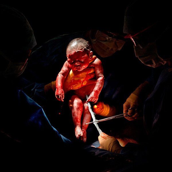 刚出生那几秒婴儿的照片
