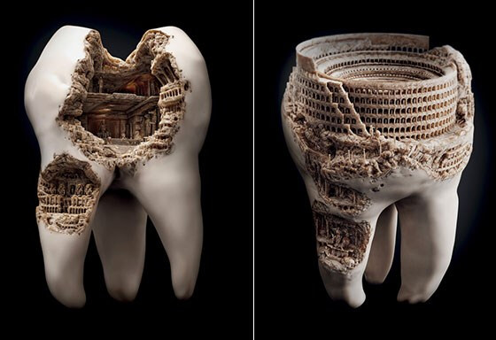 细菌牙齿广告牙齿创意广告牙膏创意广告牙膏广告牙齿上的细菌牙齿雕刻