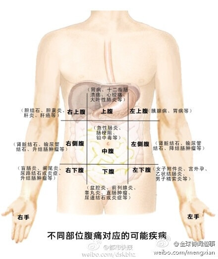 「一张图告诉你肚子痛的各种可能」