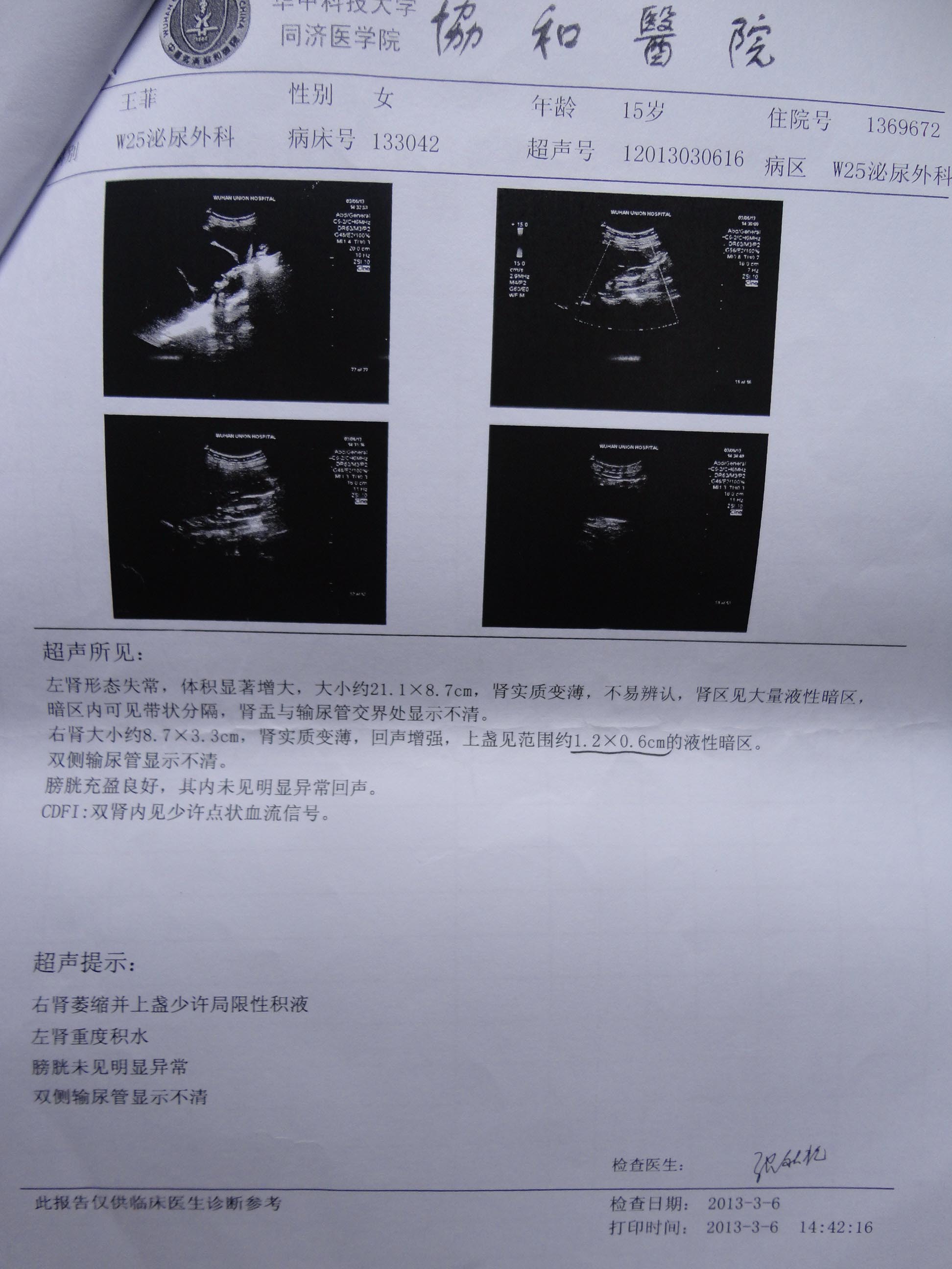 双肾萎缩 堆糖网