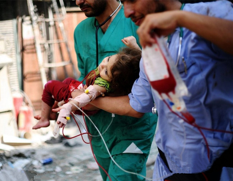战火下的平民:2012年10月9日,叙利亚阿勒颇,一名小女孩受伤.