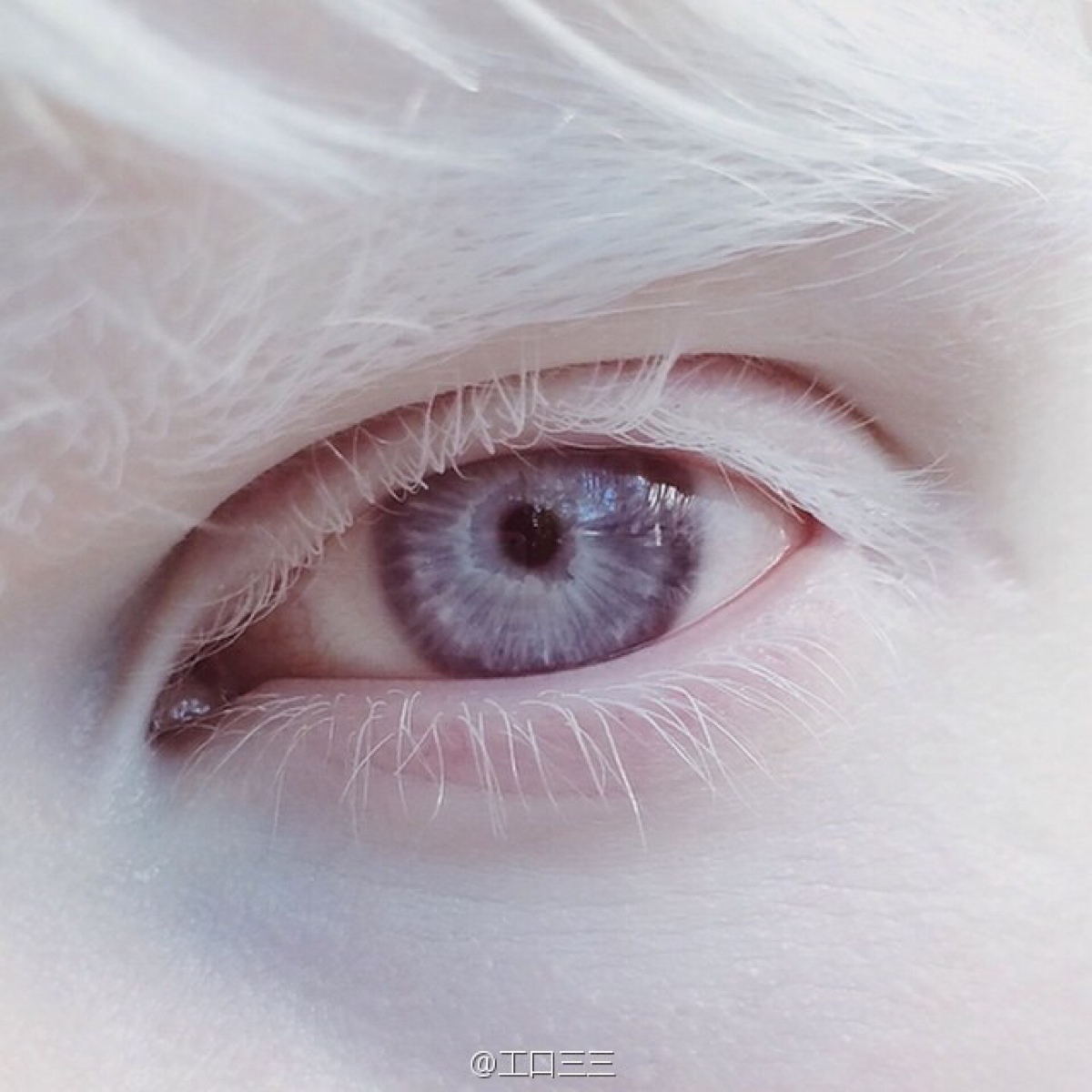 白化病人的眼睛美丽极了