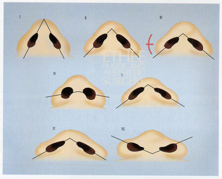 第一行是温带和寒带;第三行是热带鼻型,鼻翼宽