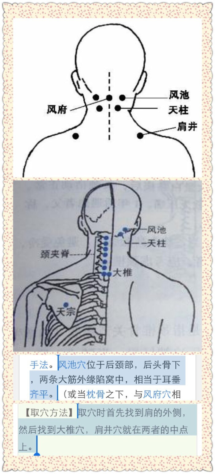 颈椎刮痧1