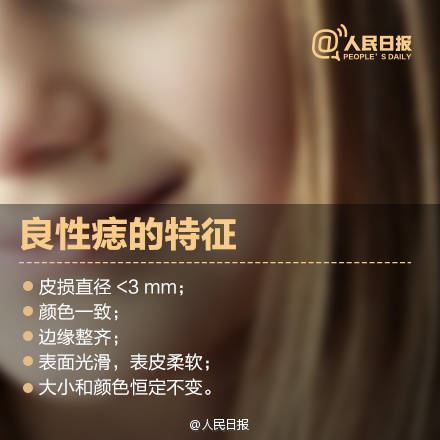 良性痣的特征有哪些?如果恶变会有哪些前兆?痣该不该点?怎样科学祛痣?