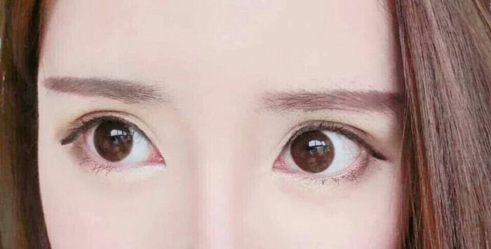 戴美瞳后眼睛肿怎么办,戴美瞳眼睛疼怎么办