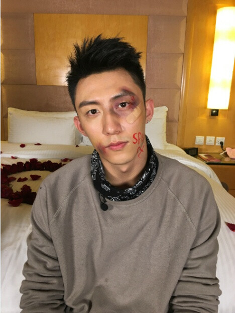 黄景瑜 上瘾 鲸鱼