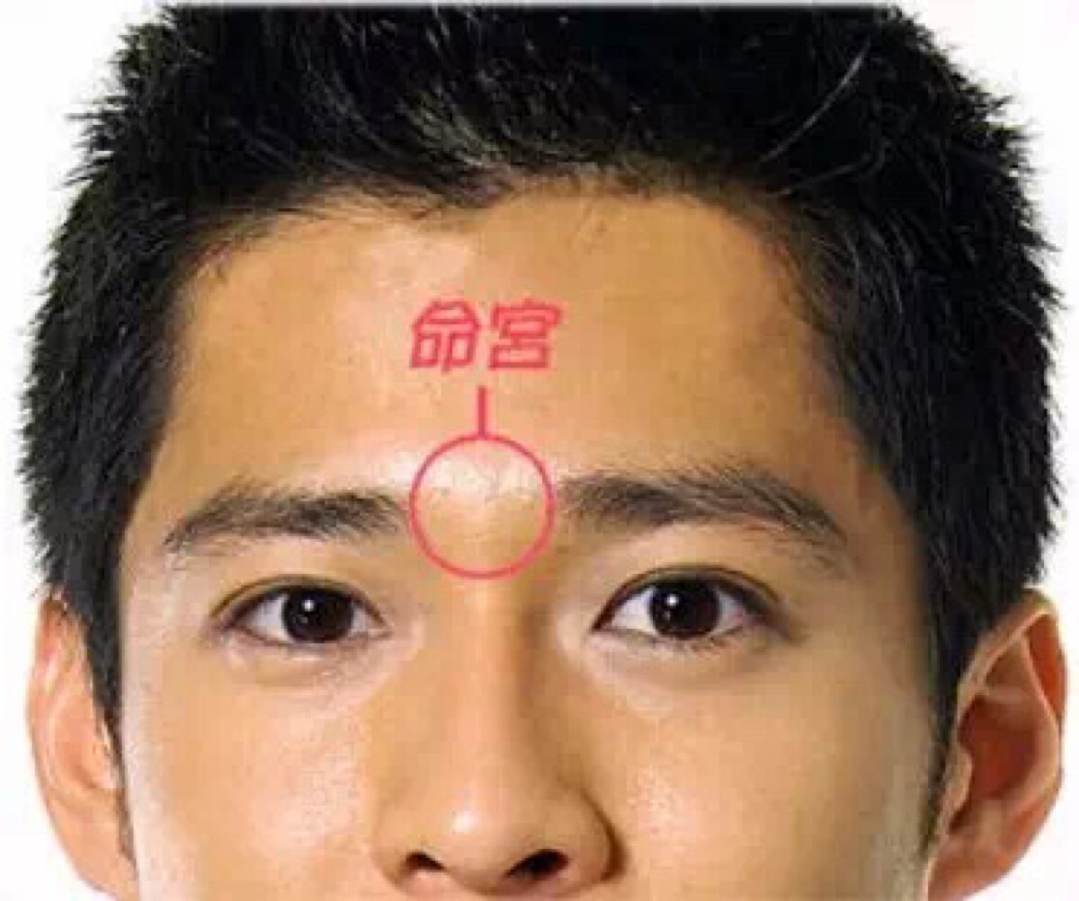 一,命宫有直纹的人此种有悬针纹,影响所及势必神经衰弱,个性偏激,易遭