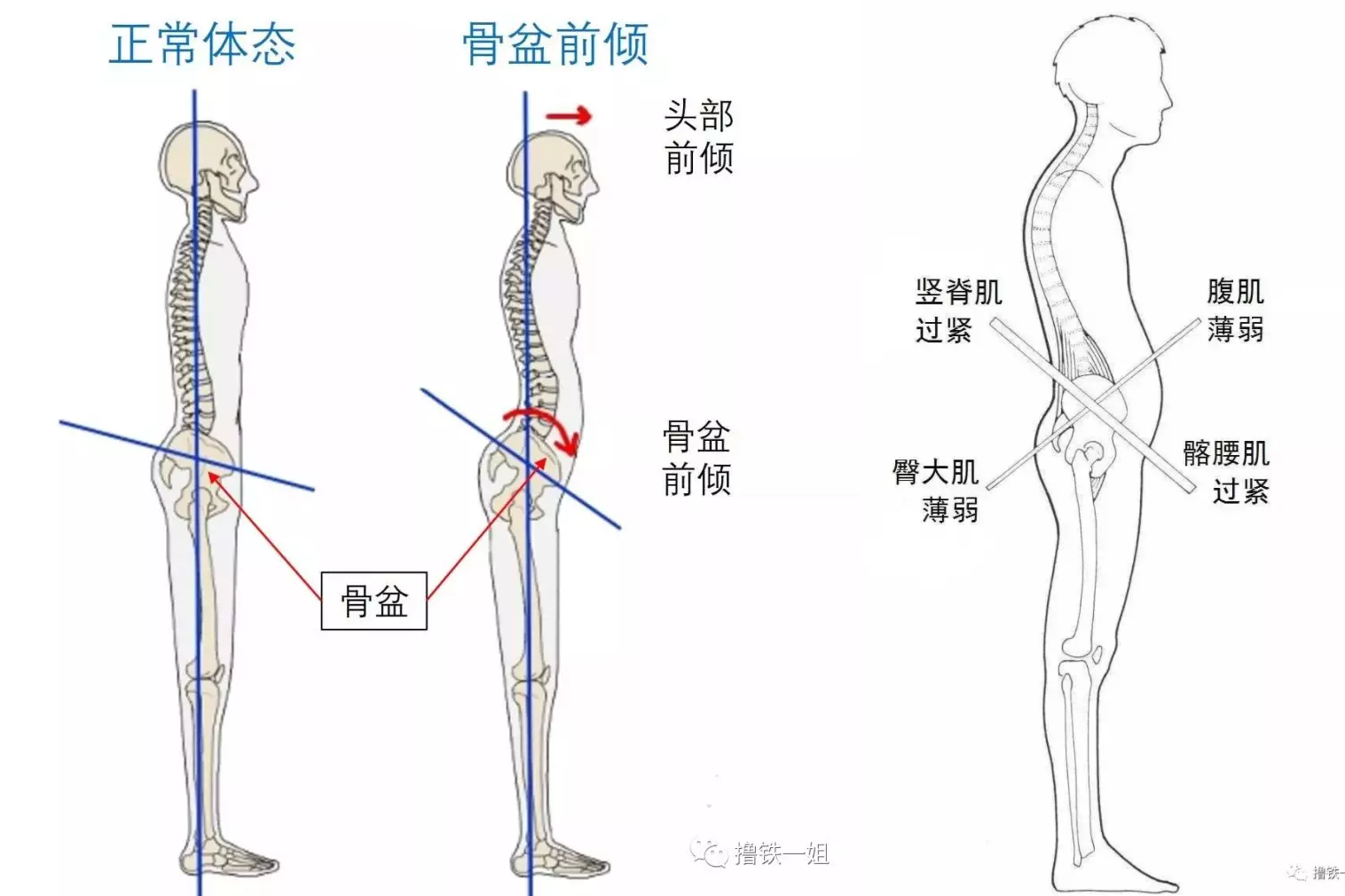 腰椎矫正鞋骨盆前倾产后倒走前价格质量 哪个牌子比较