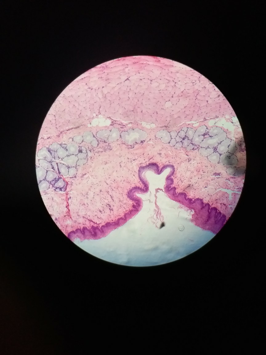 医学生专用头像 食管上皮细胞 头像 我的大学