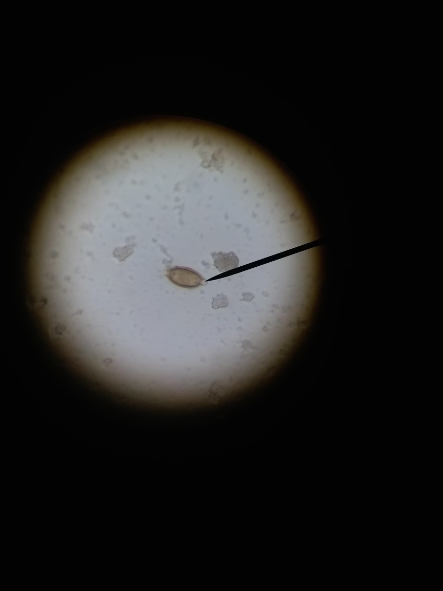 鞭虫卵纺锤形,棕黄色,两端各有一透明塞,蛋白膜包裹受精卵.