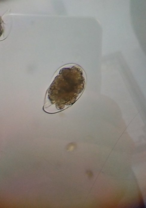 钩虫卵卵壳薄,中间有4-8个卵细胞