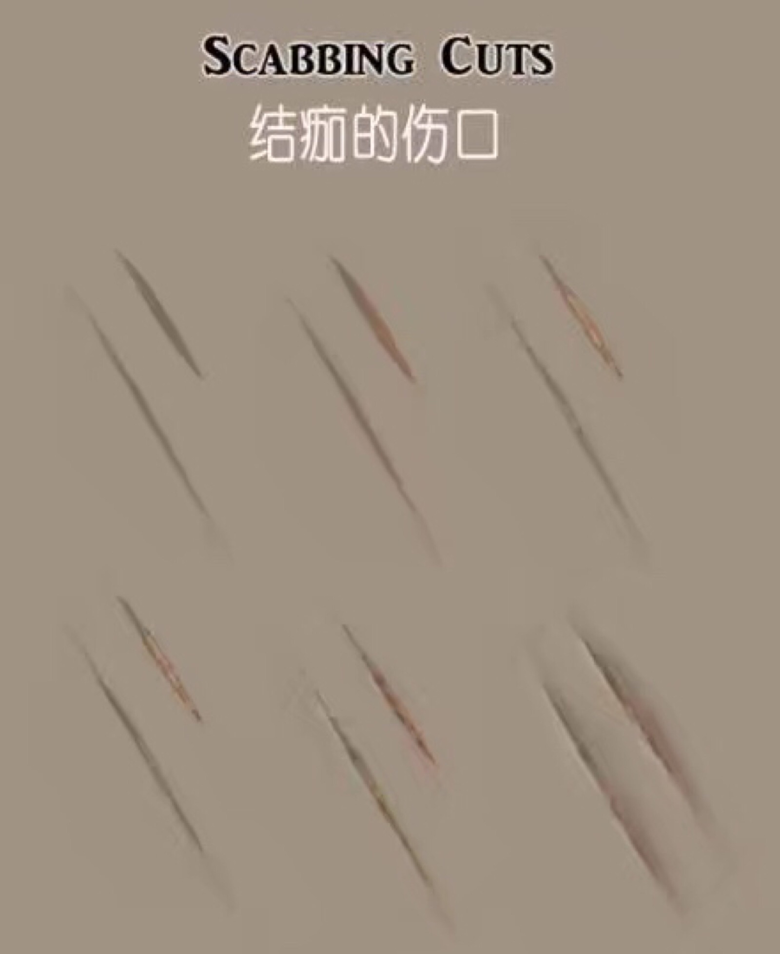 伤疤.